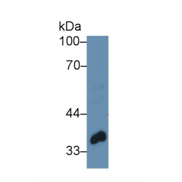 Twinfilin 1 (TWF1) Human Polyclonal Antibody