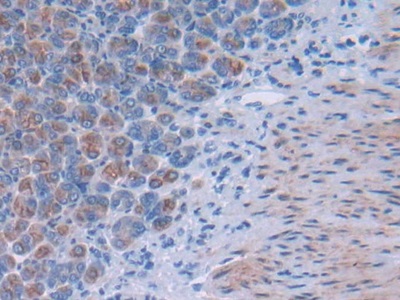 Tsukushin (TSK) Mouse Polyclonal Antibody