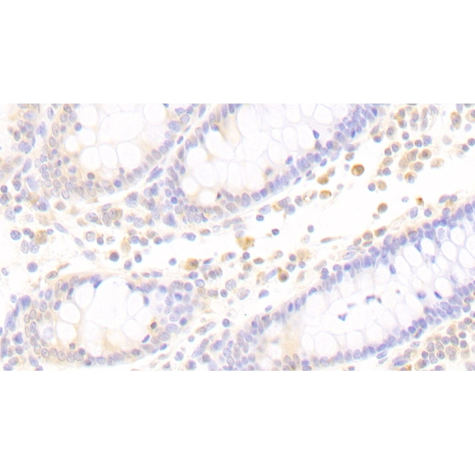 Amyloid Beta Precursor Protein Binding B1 Interacting Protein (APBB1IP) Human Polyclonal Antibody