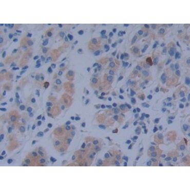 Metastasis Associated In Colon Cancer 1 (MACC1) Human Polyclonal Antibody