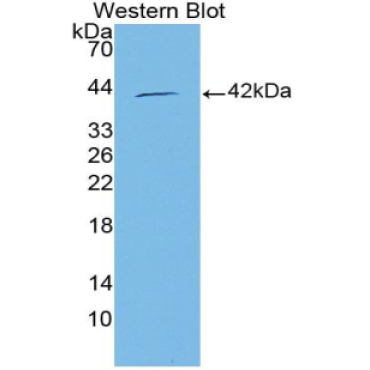 Normal Mucosa Of Esophagus Specific 1 (NMES1) Human Polyclonal Antibody