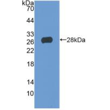 T-Cell Immunoreceptor With Ig And ITIM Domains Protein (TIGIT) Human Polyclonal Antibody