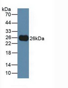 T-Cell Immunoreceptor With Ig And ITIM Domains Protein (TIGIT) Rat Polyclonal Antibody