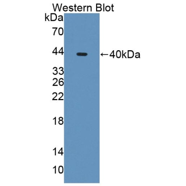 N-Acetyltransferase 8 Like Protein (NAT8L) Human Polyclonal Antibody