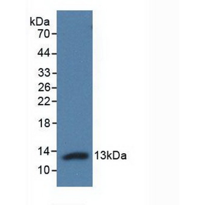 Adropin (AD) Human Polyclonal Antibody