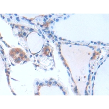 G Protein Beta Subunit Like Protein (GbL) Human Polyclonal Antibody