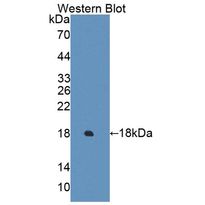 Esophageal Cancer Related Gene 4 (ECRG4) Human Polyclonal Antibody