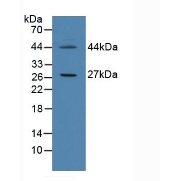Cell Death Inducing DFFA Like Effector C (CIDEC) Human Polyclonal Antibody