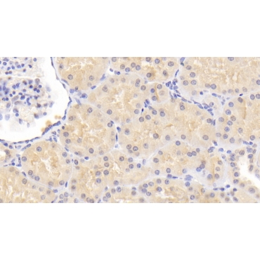 Progesterone Immunomodulatory Binding Factor 1 (PIBF1) Human Polyclonal Antibody