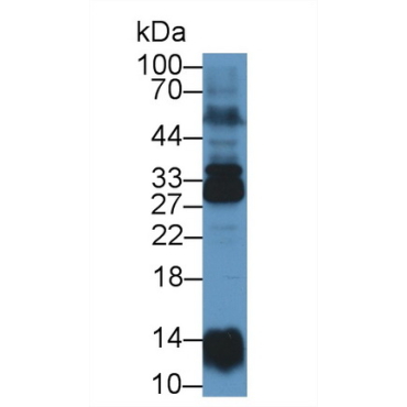 Non Metastatic Cells 6, Protein Expressed In (NME6) Human Polyclonal Antibody