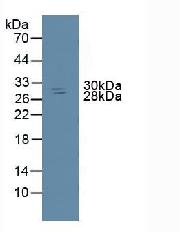Non Metastatic Cells 6, Protein Expressed In (NME6) Rat Polyclonal Antibody
