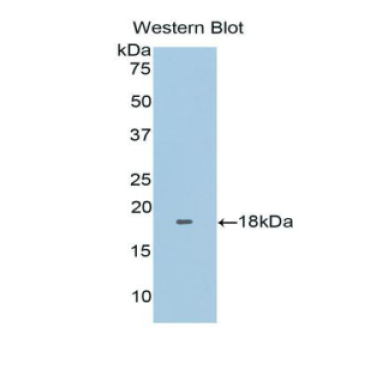 Fibronectin Type III Domain Containing Protein 5 (FNDC5) Human Polyclonal Antibody