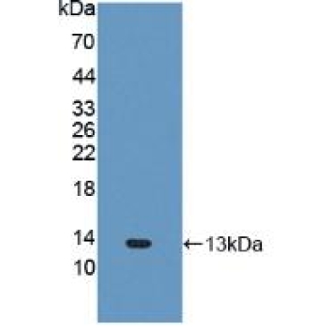 Fibronectin Type III Domain Containing Protein 5 (FNDC5) Human Polyclonal Antibody