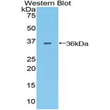 Dispatched Homolog 1 (DISP1) Mouse Polyclonal Antibody