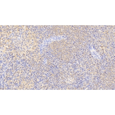 Pim-3 Oncogene (PIM3) Human Polyclonal Antibody