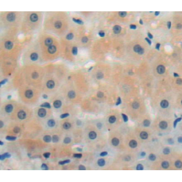 Chemokine Like Factor Superfamily 8 (CKLFSF8) Human Polyclonal Antibody