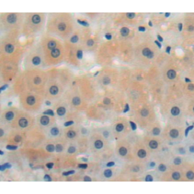 Chemokine Like Factor Superfamily 8 (CKLFSF8) Human Polyclonal Antibody