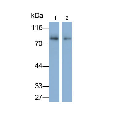 Hermansky Pudlak Syndrome Protein 6 (HPS6) Human Polyclonal Antibody