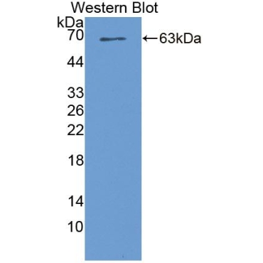 Serine/Threonine Kinase 39 (STK39) Human Polyclonal Antibody