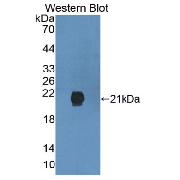 Gremlin 2 (GREM2) Human Polyclonal Antibody