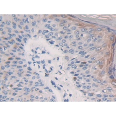 GRB2 Associated Binding Protein 3 (GAB3) Human Polyclonal Antibody