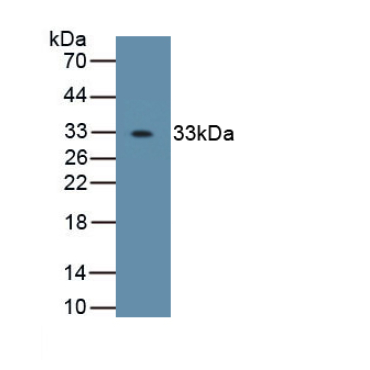 Osterix (OSX) Human Polyclonal Antibody