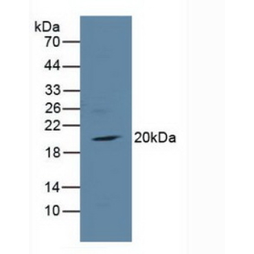Toll Interleukin 1 Receptor Domain Containing Adaptor Protein (TIRAP) Human Polyclonal Antibody
