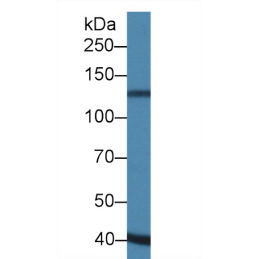 A Disintegrin And Metalloproteinase With Thrombospondin 19 (ADAMTS19) Human Polyclonal Antibody
