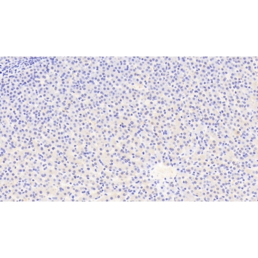 Autophagy Related Protein 16 Like Protein 1 (ATG16L1) Human Polyclonal Antibody