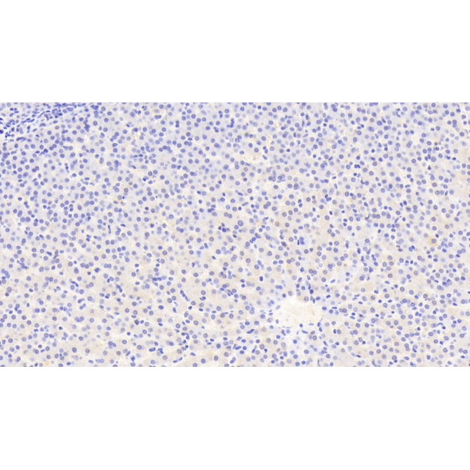 Autophagy Related Protein 16 Like Protein 1 (ATG16L1) Human Polyclonal Antibody