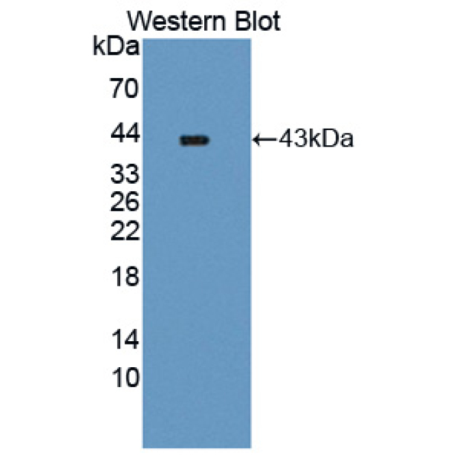 A Disintegrin And Metalloproteinase With Thrombospondin 16 (ADAMTS16) Human Polyclonal Antibody