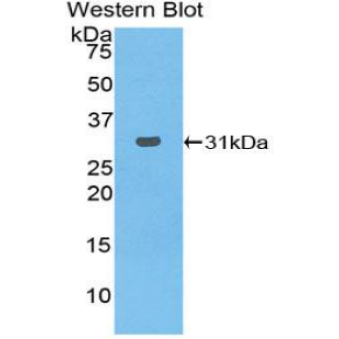 Checkpoint Kinase 2 (CHEK2) Human Polyclonal Antibody