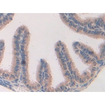 Caspase Recruitment Domain Family, Member 9 (CARD9) Mouse Polyclonal Antibody