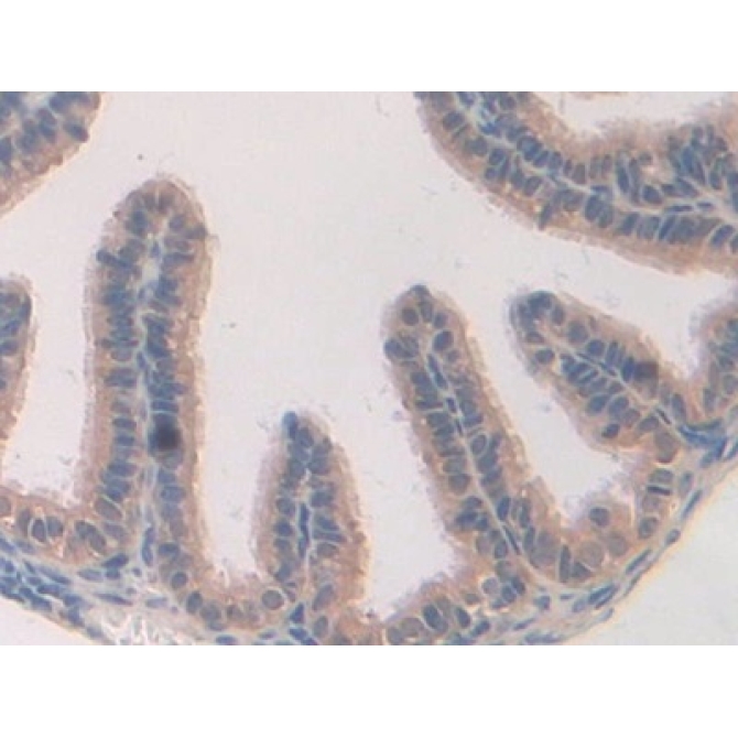 Caspase Recruitment Domain Family, Member 9 (CARD9) Mouse Polyclonal Antibody