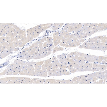 Myosin Heavy Chain 7B, Cardiac Muscle Beta (MYH7B) Human Polyclonal Antibody