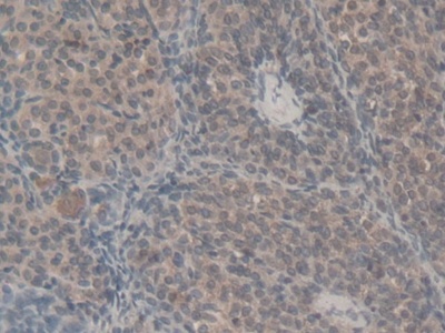 Retinol Binding Protein 5, Cellular (RBP5) Rat Polyclonal Antibody