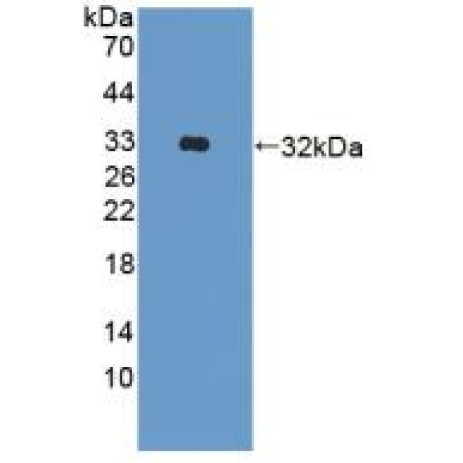 A Disintegrin And Metalloprotease 33 (ADAM33) Human Polyclonal Antibody