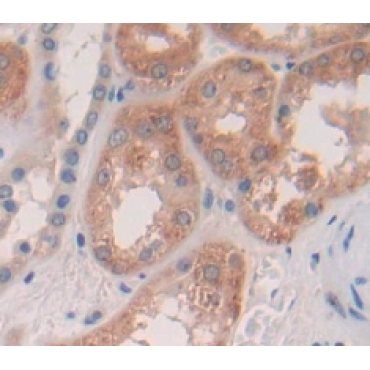 PR Domain Containing Protein 14 (PRDM14) Human Polyclonal Antibody