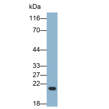 Wingless Type MMTV Integration Site Family, Member 10B (WNT10B) Human Polyclonal Antibody