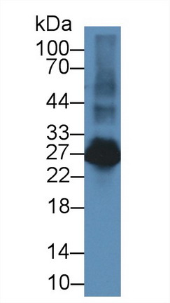 Linker For Activation Of T-Cells Family, Member 2 (LAT2) Rat Polyclonal Antibody