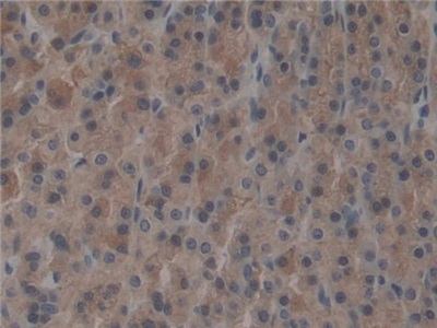 T-Box Protein 21 (TBX21) Rat Polyclonal Antibody