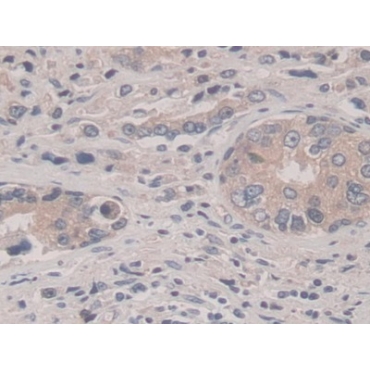 Suppression Of Tumorigenicity 14 (ST14) Human Polyclonal Antibody