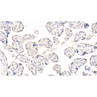 Proteasome 26S Subunit, Non ATPase 8 (PSMD8) Human Polyclonal Antibody