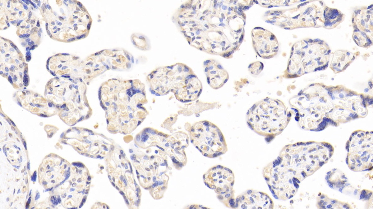 Proteasome 26S Subunit, Non ATPase 8 (PSMD8) Human Polyclonal Antibody