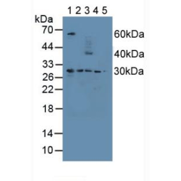 Proteasome 26S Subunit, Non ATPase 9 (PSMD9) Human Polyclonal Antibody