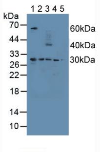 Proteasome 26S Subunit, Non ATPase 9 (PSMD9) Human Polyclonal Antibody