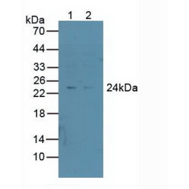 Proteasome 26S Subunit, Non ATPase 10 (PSMD10) Human Polyclonal Antibody