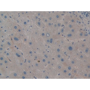 Pim-2 Oncogene (PIM2) Human Polyclonal Antibody