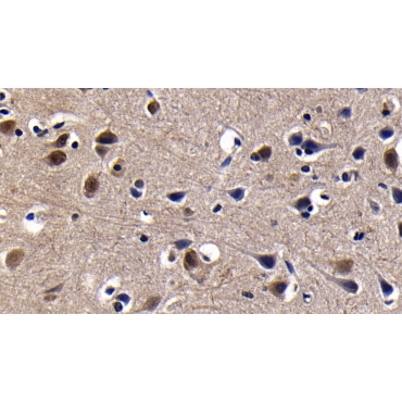 Poly ADP Ribose Glycohydrolase (PARG) Human Polyclonal Antibody