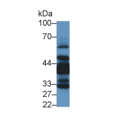 LIM And Senescent Cell Antigen Like Domains Protein 1 (LIMS1) Human Polyclonal Antibody